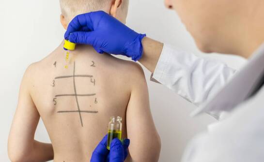 Jak rozpoznaje się alergie u dzieci?