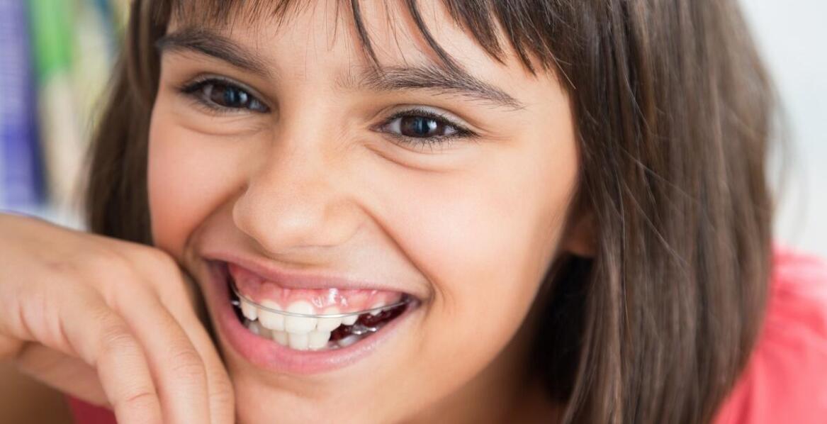 Leczenie zębów mlecznych: dlaczego jest ważne dla zdrowia przyszłych zębów stałych?