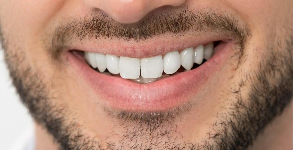 Implanty zębowe - trwałe rozwiązanie dla brakujących zębów