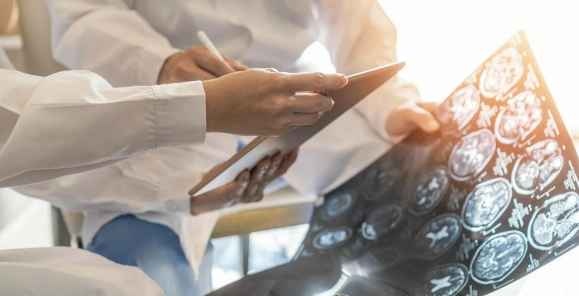 Ocena stanów po urazach czaszkowo-mózgowych dzięki badaniom EEG