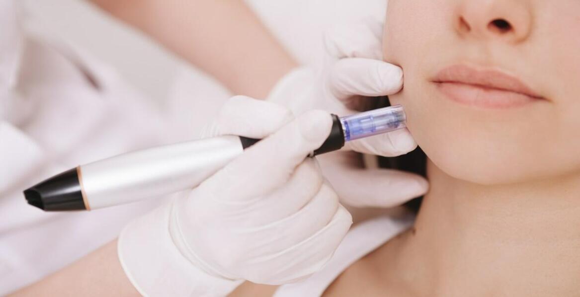 Czy radiofrekwencja mikroigłowa jest bezpieczna dla każdego typu skóry?