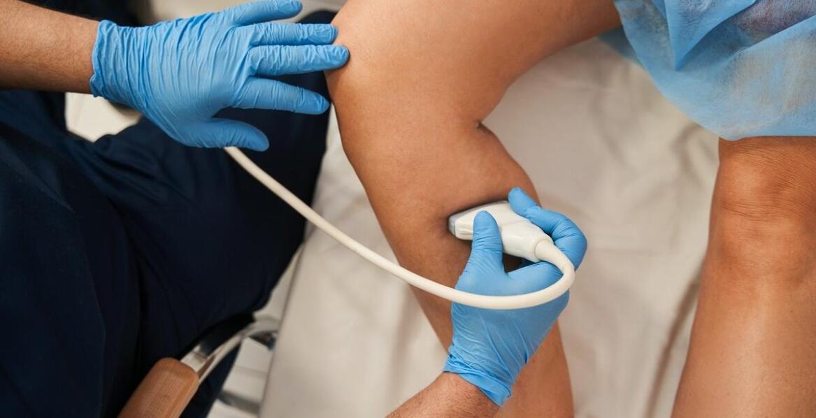 Czy usuwanie żylaków jest bolesne?