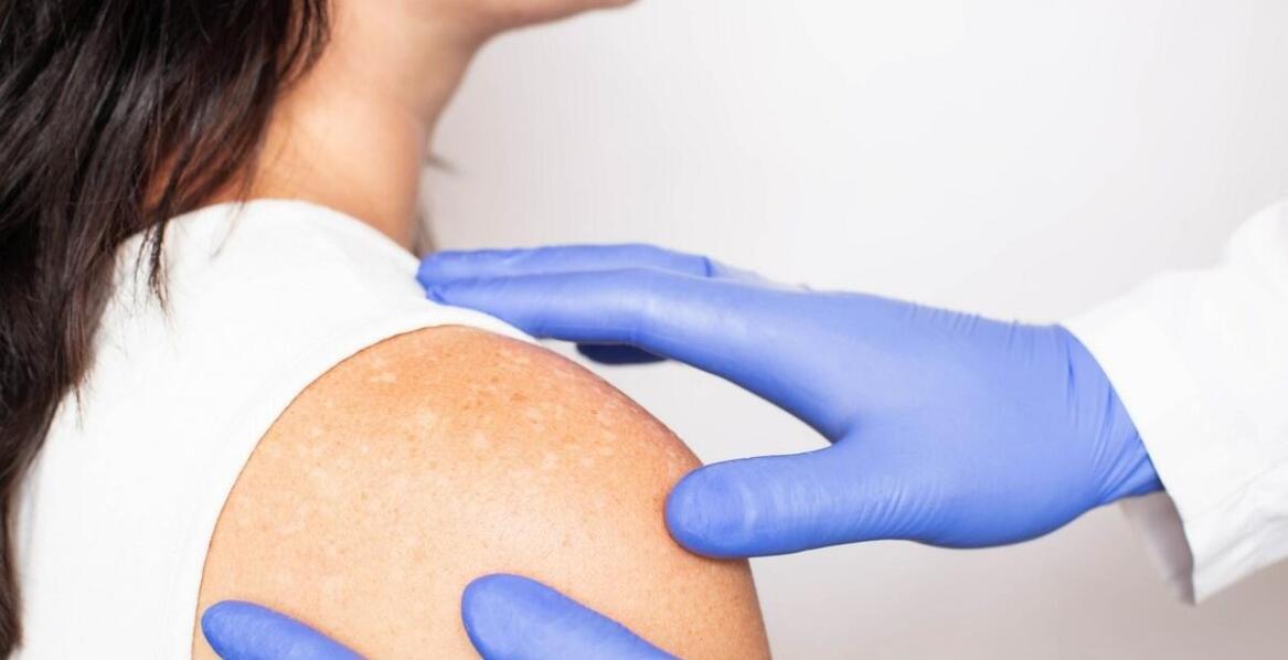 Jak diagnostyka skóry może pomóc w poprawie jej kondycji?