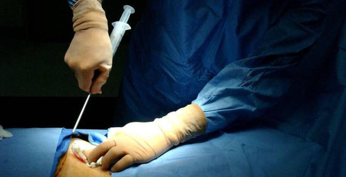 Artroskopia barku - mało inwazyjna metoda diagnostyki i leczenia
