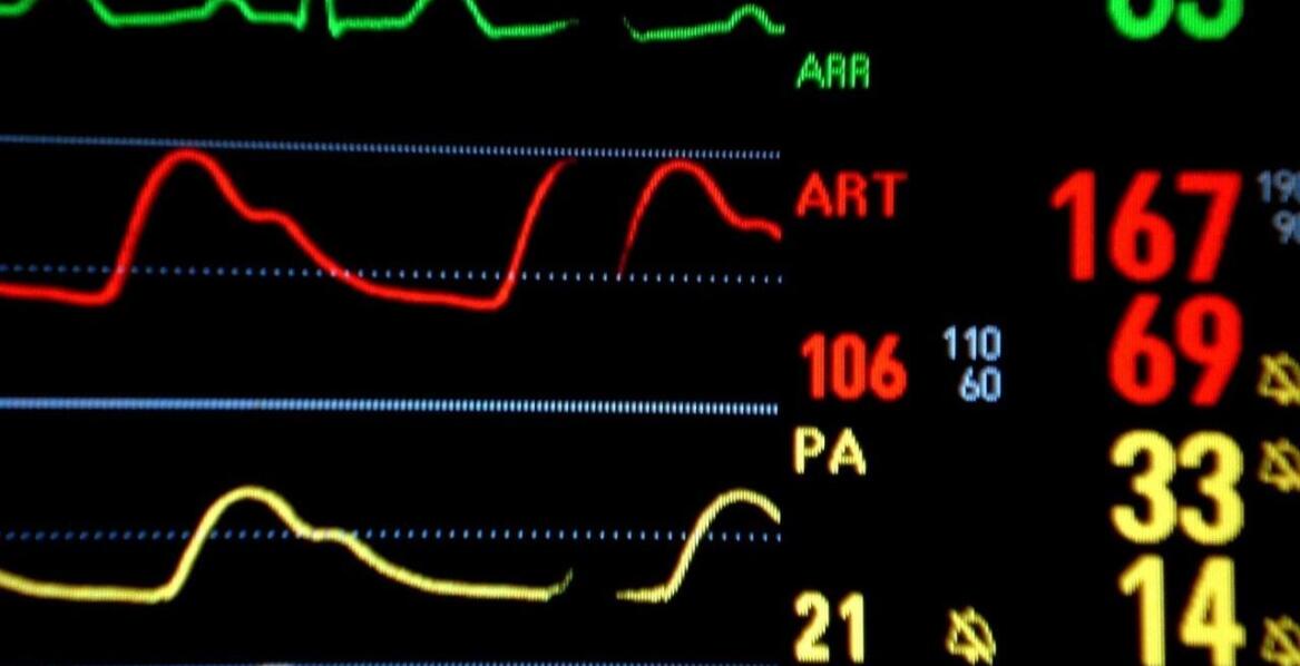 Czym jest badanie EKG?