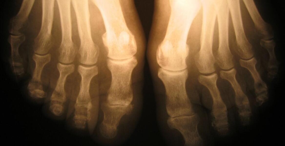 Czym zajmuje się ortopedia?