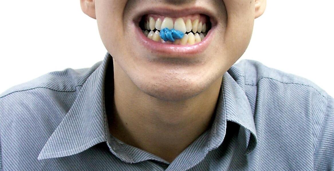 Dlaczego warto odwiedzać dentystów? – paradontoza