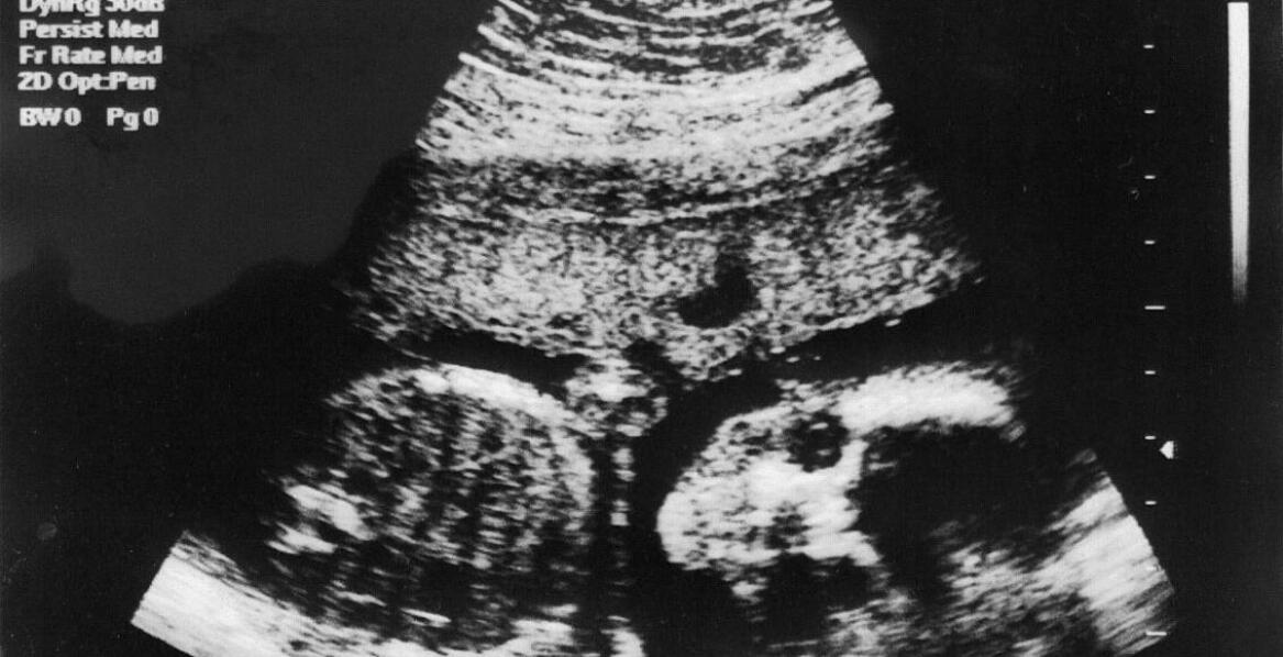 Obrazowanie cyfrowe w medycynie