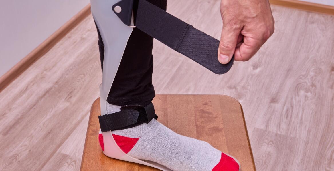 Jakie ortezy produkuje się dzięki drukarkom 3D?