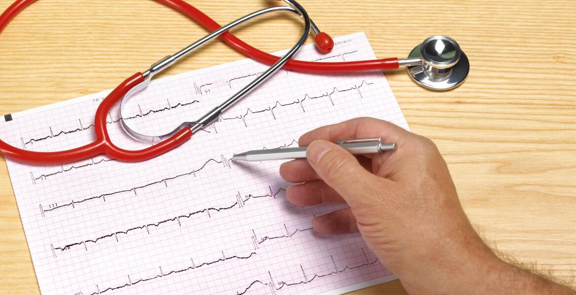 Co pozwala wykryć badanie EKG? 