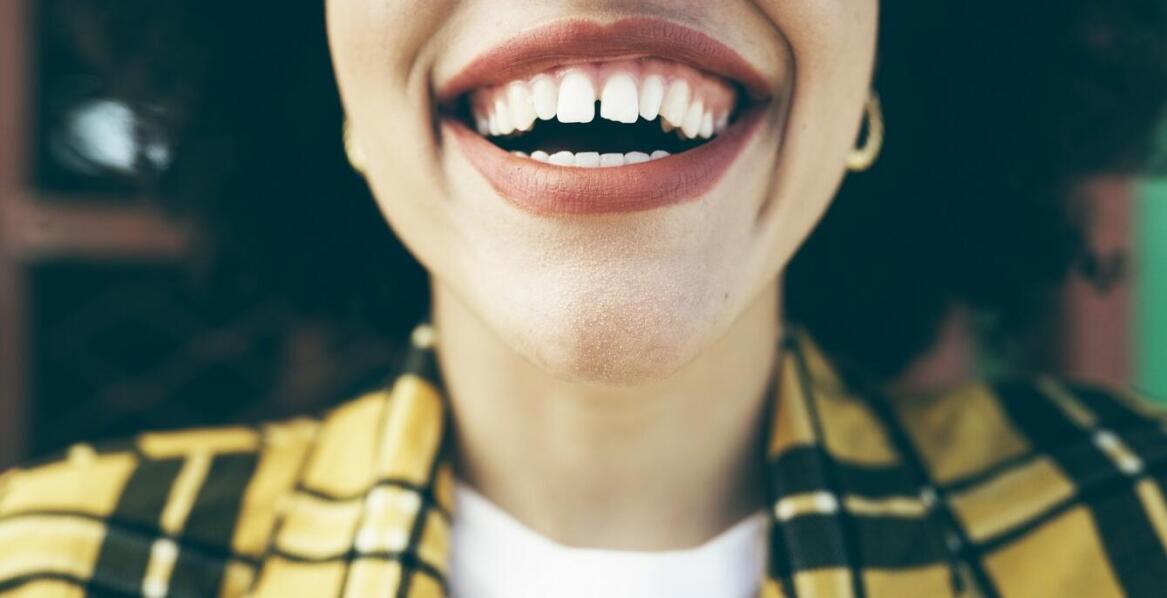 Wybielanie zębów - najczęstsze mity i fakty