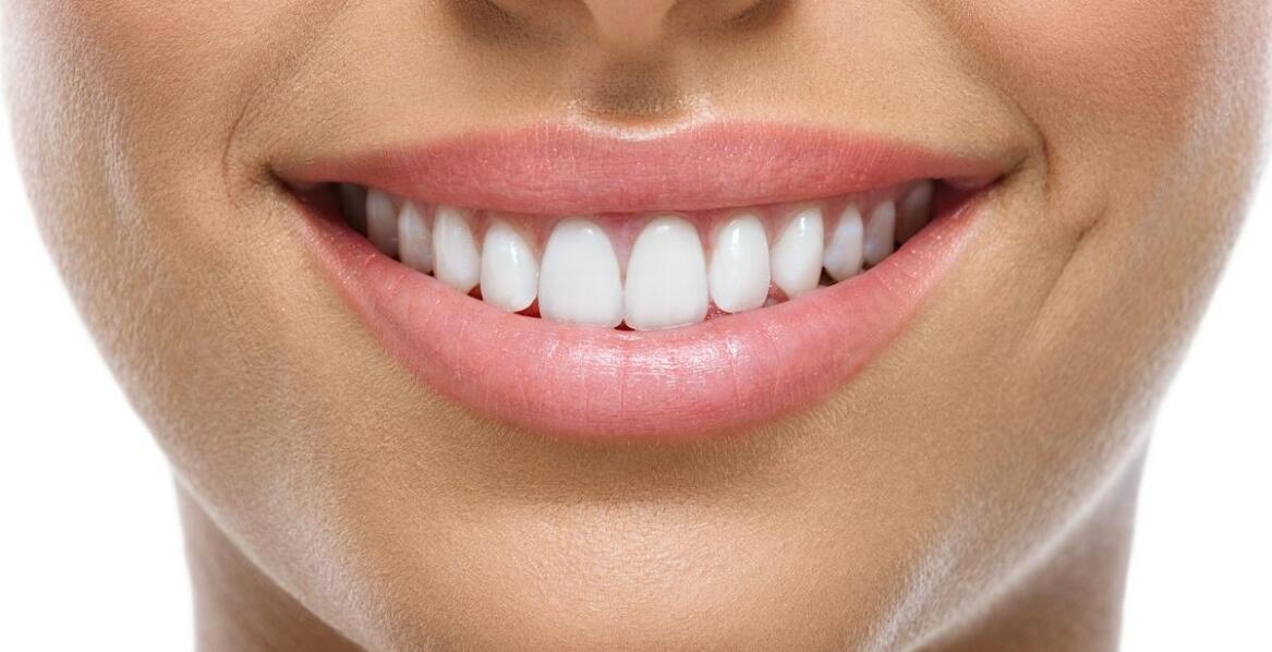 Licówki porcelanowe w przypadku przebarwień zębów – efekty przed i po