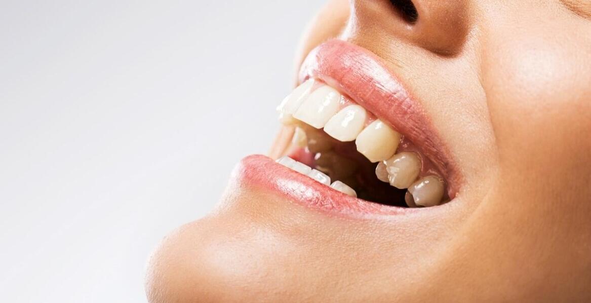 Co to jest ortodoncja lingwalna i jakie ma zalety?