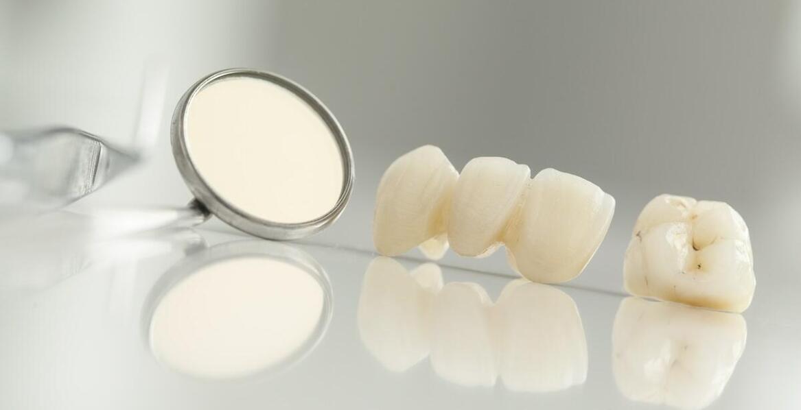 Jakie czynniki wpływają na wybór odpowiednich koron porcelanowych?