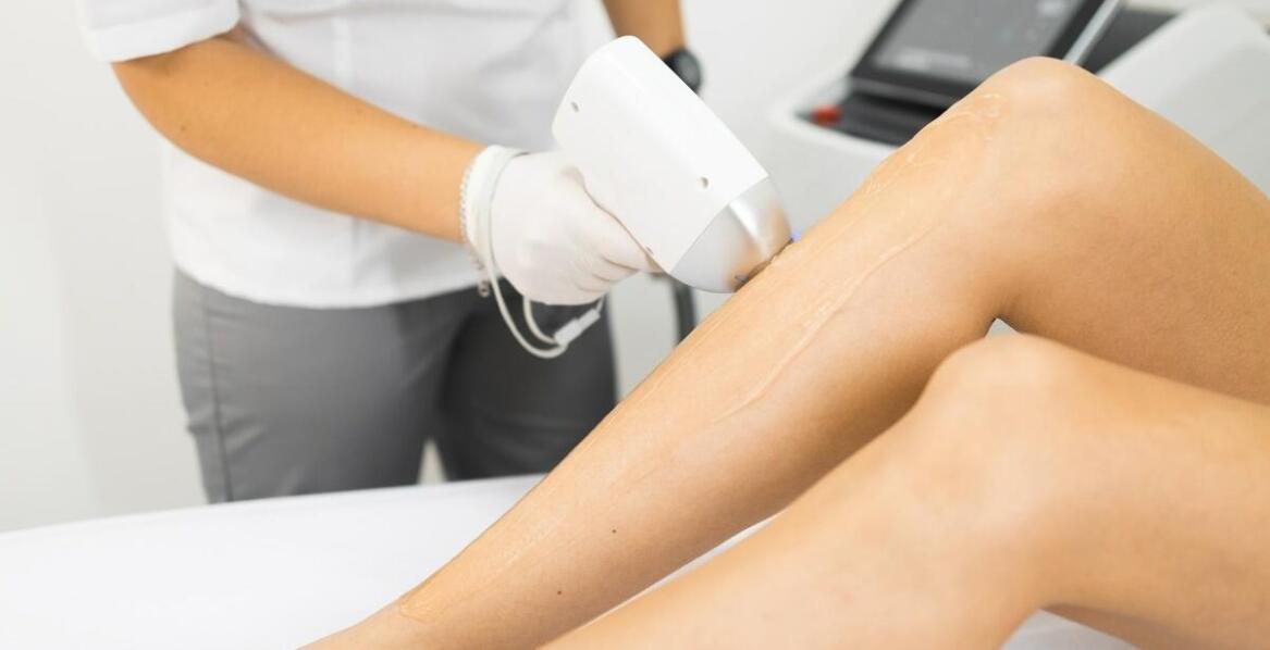 Na czym polega depilacja laserowa? Przewodnik dla początkujących