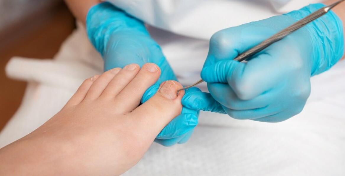 Pedicure medyczny Bydgoszcz – idealne rozwiązanie dla osób z cukrzycą