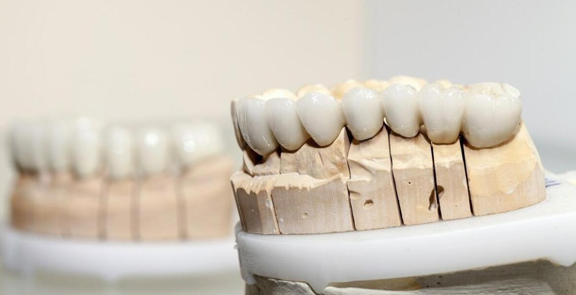 Dlaczego warto zainwestować w trwałe rozwiązania protetyczne?