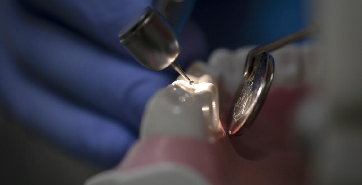 Dlaczego warto stosować glasjonomer w leczeniu ubytków zębowych?