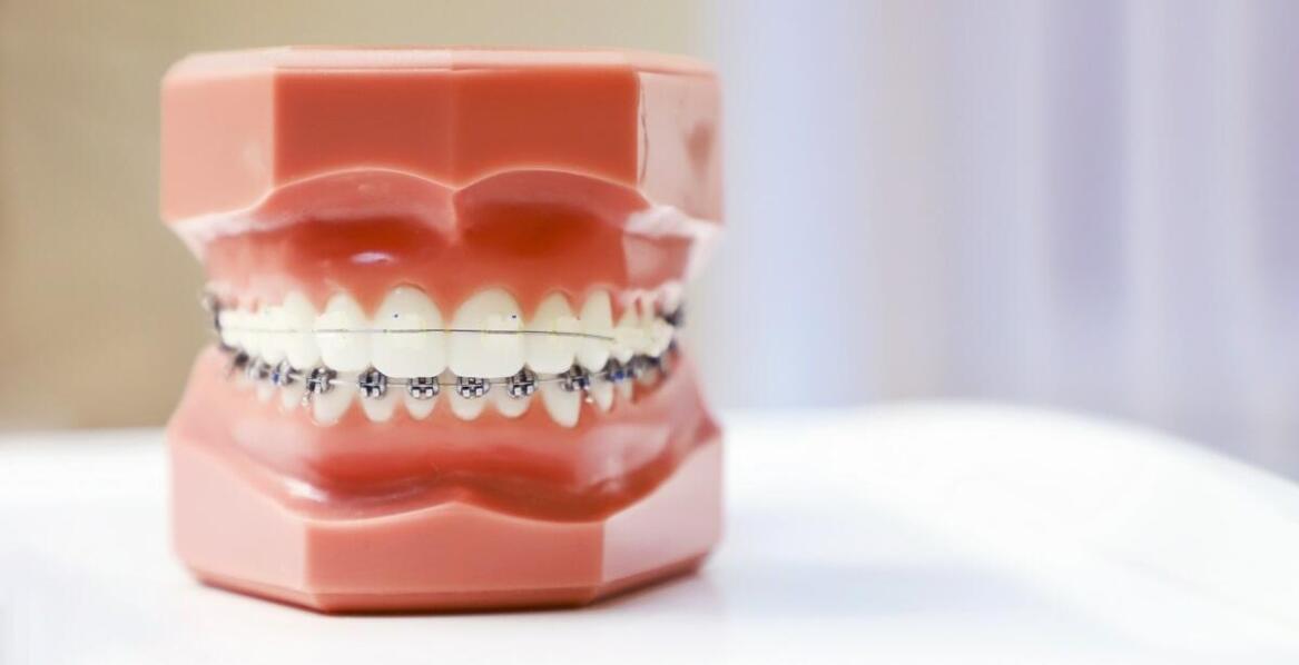 Ortodonta a zdrowie jamy ustnej – jak leczenie ortodontyczne wpływa na ogólny stan zdrowia?