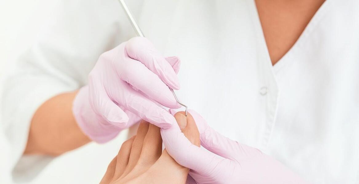 Jak przebiega rekonstrukcja paznokcia w gabinecie podologicznym?