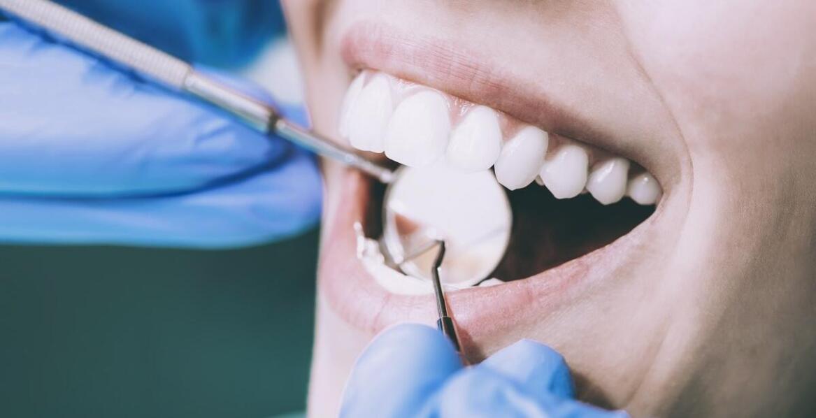 Proces bondingu - jak przebiega zabieg w nowoczesnej stomatologii?