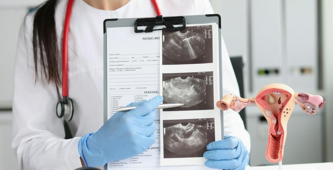 Kluczowe aspekty wyboru ultrasonografu do praktyki ginekologicznej