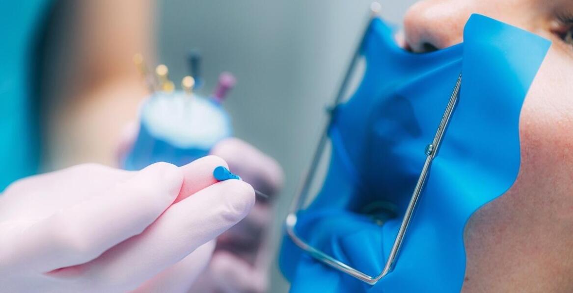 Jak wygląda proces piaskowania zębów w klinice stomatologicznej?