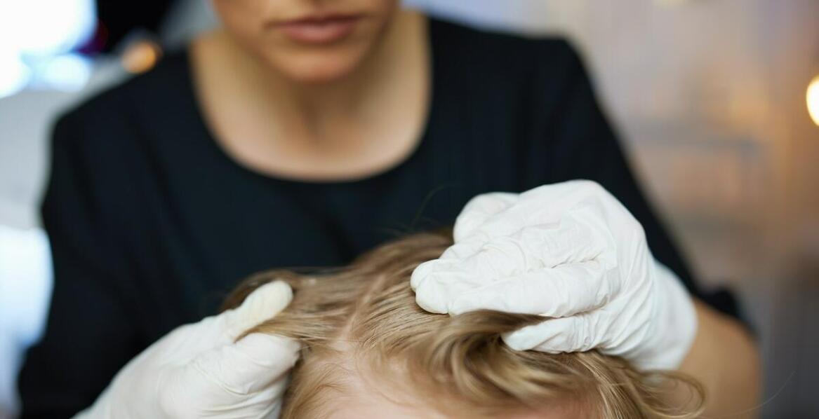 Jak salon trychologiczny może pomóc w walce z łupieżem?