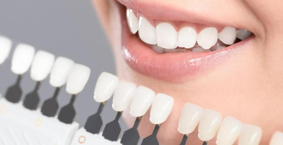 Bezpieczne wybielanie zębów w Gdańsku: ochrona szkliwa i długotrwałe efekty
