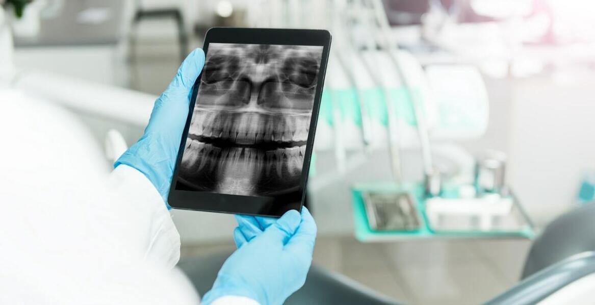 Zdjęcia panoramiczne zębów – znaczenie w nowoczesnej stomatologii