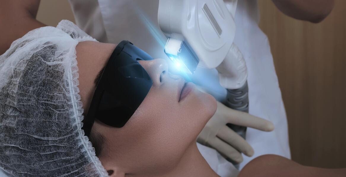 Efekty laseroterapii twarzy w redukcji blizn i przebarwień – co mówią pacjenci?