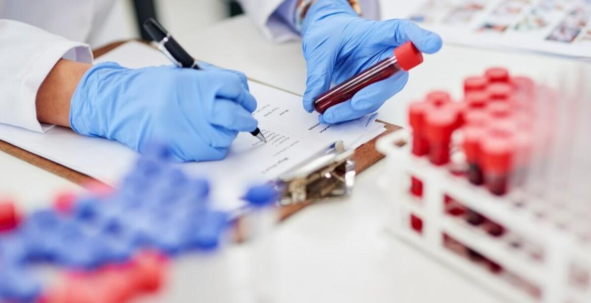 Rola morfologii krwi w diagnozowaniu niedoborów żywieniowych