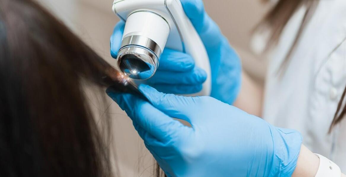 Skuteczne metody leczenia łupieżu w klinice trychologicznej