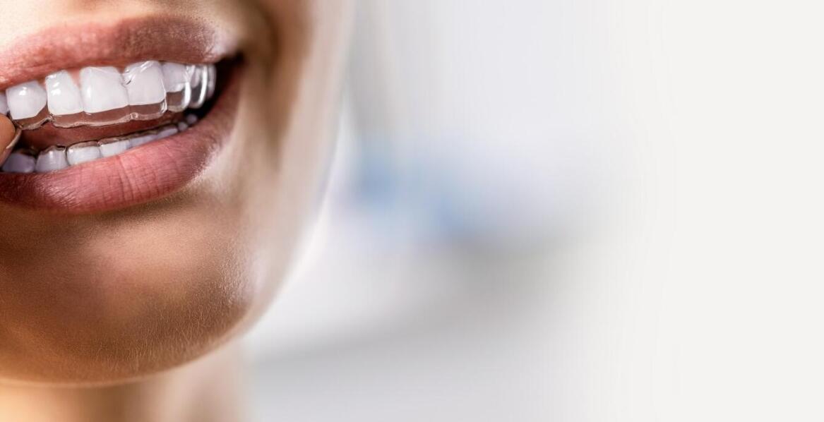 Zalety implantów zębów w porównaniu do tradycyjnych protez