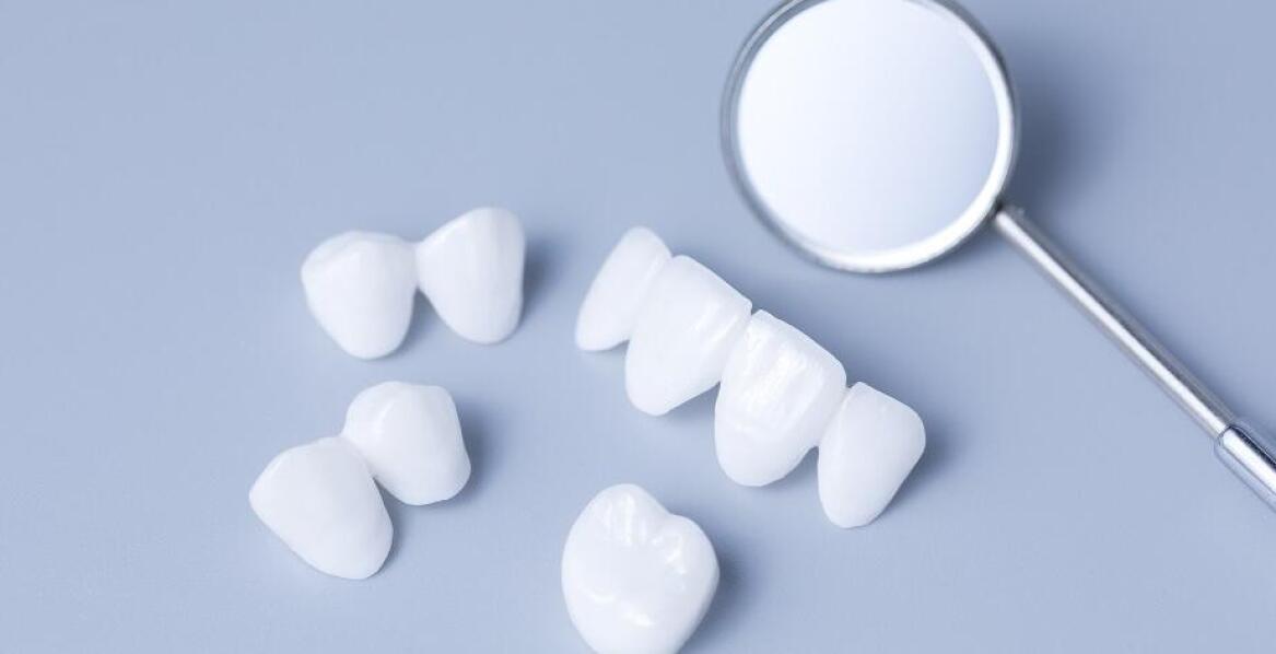 Jakie są zalety stosowania licówek w stomatologii estetycznej?