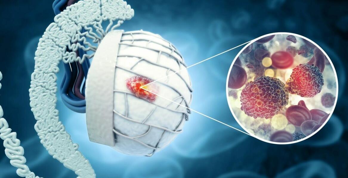 Jakie objawy neurologiczne mogą towarzyszyć oponiakom mózgu?