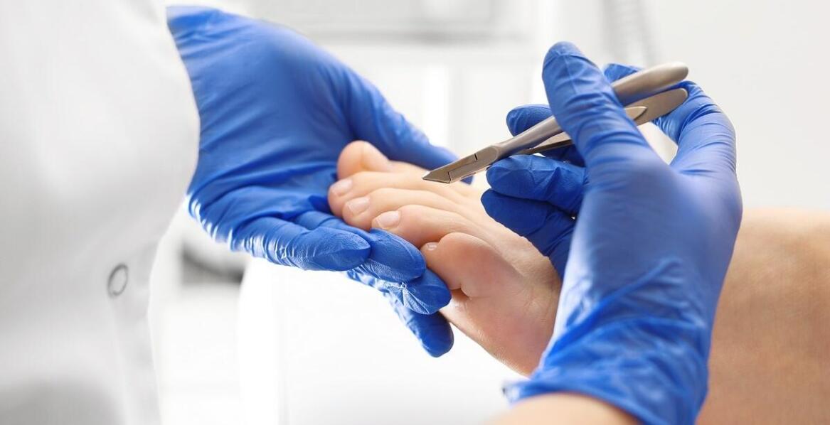 Jakie są najczęstsze mity dotyczące leczenia brodawek w gabinetach podologicznych?