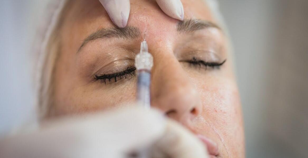 Toksyna botulinowa w medycynie estetycznej – jak działa na zmarszczki mimiczne?
