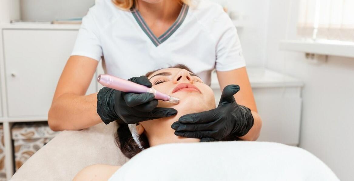 Kluczowe zalety mezoterapii mikroigłowej w odmładzaniu skóry