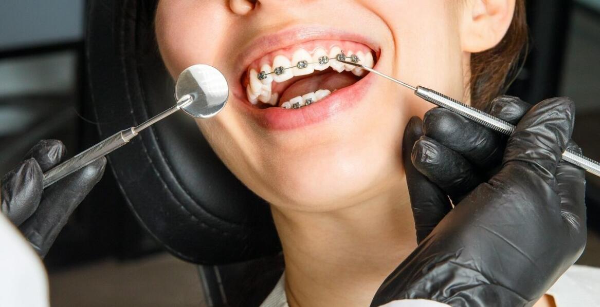 Jak ortodoncja funkcjonalna poprawia jakość życia pacjentów w Łomży