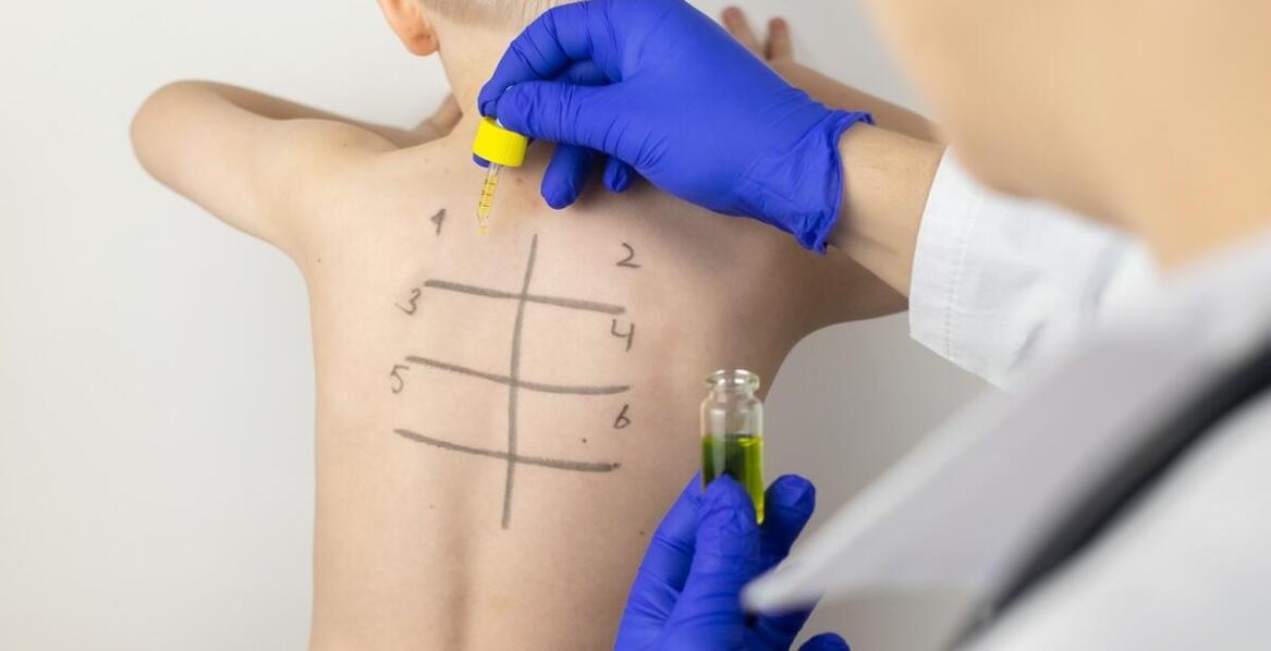 Jak rozpoznaje się alergię u dzieci?