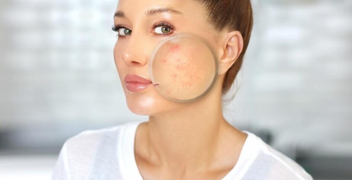 Dermatolog estetyczny a innowacyjne metody leczenia blizn