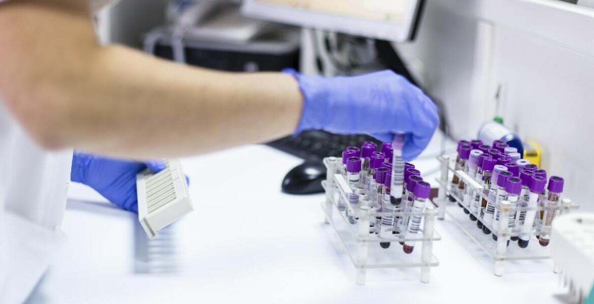 Jakie testy laboratoryjne są istotne dla pacjentów z podejrzeniem chorób metabolicznych?