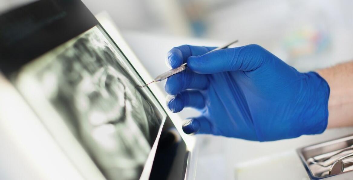 Znaczenie dokładności obrazowania RTG zębów w leczeniu endodontycznym