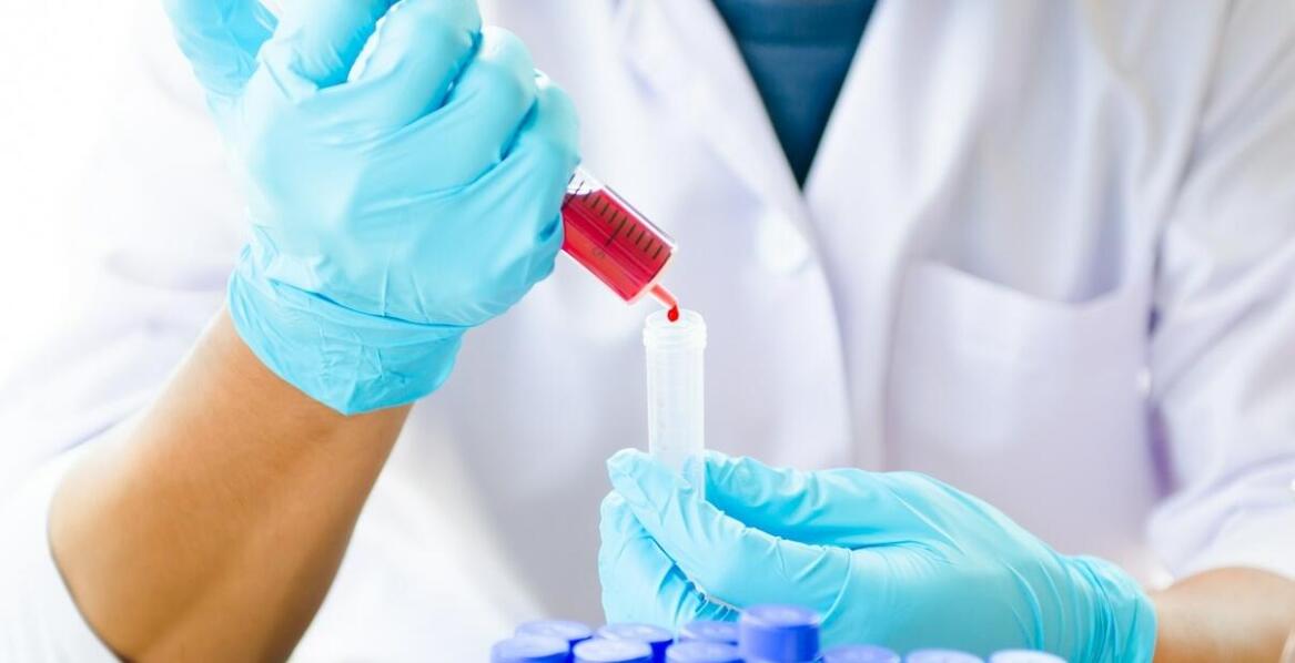 Czego można się spodziewać po wynikach testów toksykologicznych?