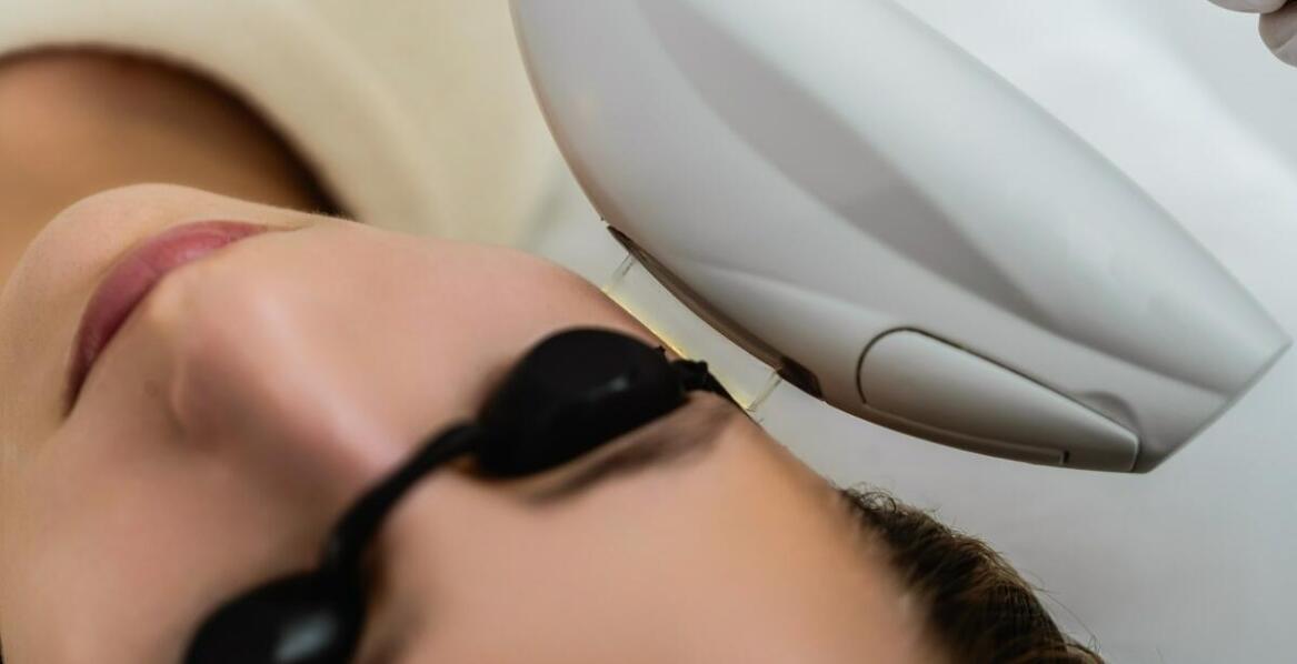 Fototerapia BBL: Czego można się spodziewać po zabiegu?