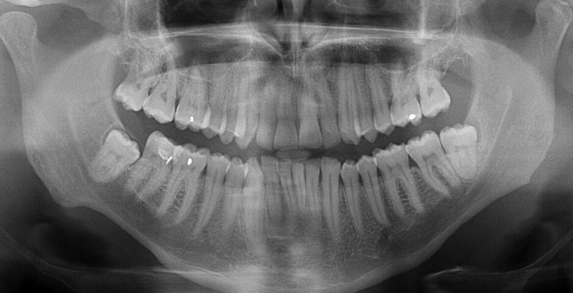 Jak radiowizjografia wspiera diagnostykę w stomatologii estetycznej?