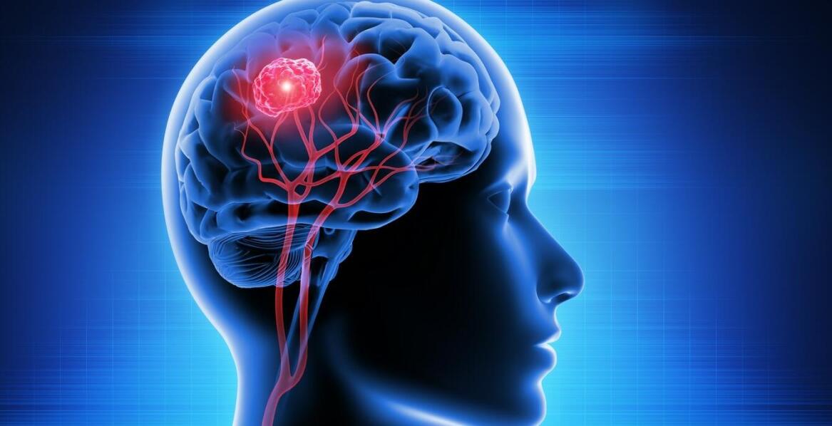 Znaczenie diagnostyki różnicowej w przypadku podejrzenia guza przysadki