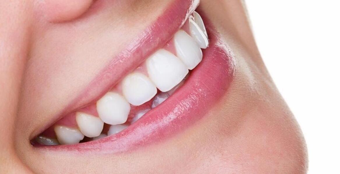 Czy bonding jest trwałym rozwiązaniem? Fakty i mity