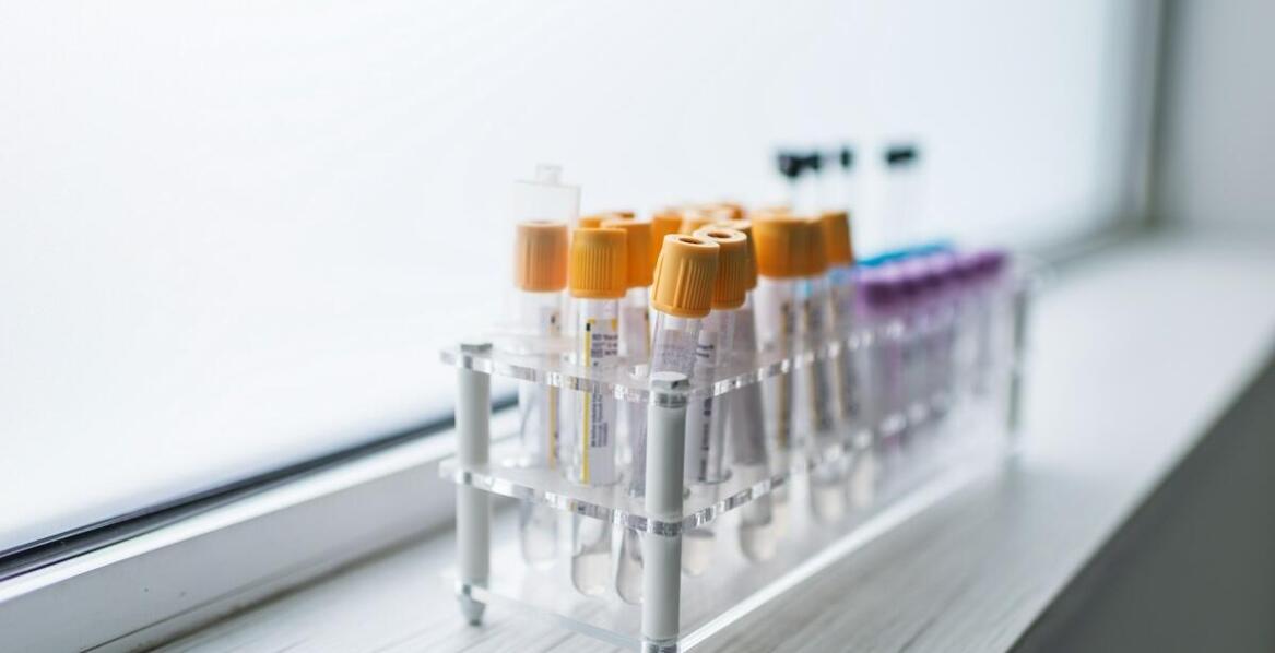 Jakie są najważniejsze cechy wirówki do I-PRF w kontekście terapii PRF?